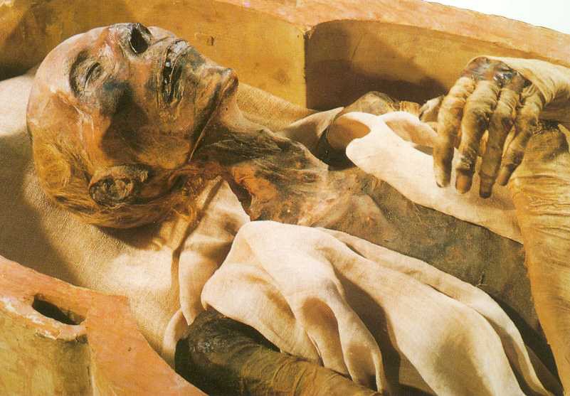 Mummy preserved with ancient knowledge of germicides