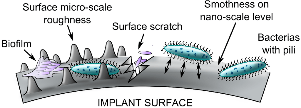 Image of implant surface with biofilm and bacteria adhering to areas which are rough, scratched and nano-scale smoothness